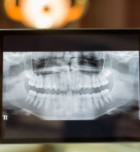 טכנולוגיות מתקדמות לטובת רפואת השיניים-תמונה